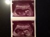 12 wk 6 dg.jpg