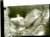 babyecho.jpg