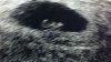 IMG-20161202-WA0002.jpg