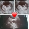 Photo Collage Maker_EvHHl7.jpg