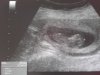 IMG-20161212-WA0004.jpg