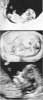 519916d1481024949-skull-theory-collage.jpg