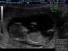 J165347_607879_Echo.jpg