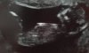 20161227_115647.jpg