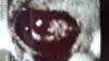 IMG-20161223-WA0001.jpg