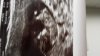 IMG-20170103-WA0002.jpg