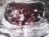 20170106_155658.jpg