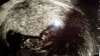 20170107_084627.jpg