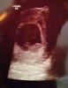 IMG-20170106-WA0002-1.jpg