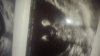 IMG-20170119-WA0004.jpg