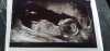 thumbnail_IMG-20170125-WA0011.jpg