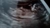 20170126_172837.jpg
