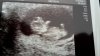 20170207_095510.jpg