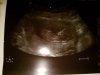 20170217_124335.jpg