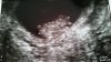 20170221_094003.jpg