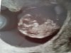 20170222_130604.jpg