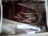 image-2017-02-28 (2) potty shot.jpg