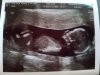 image-2017-02-28 (1) foto baby.jpg