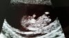 20170302_135045.jpg