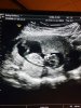 IMG-20170313-WA0000.jpg