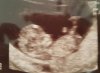 20170317_095204.jpg