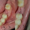 20170321_211459.jpg