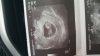 IMG-20170318-WA0005.jpg