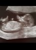 20170322_114956.jpg