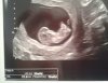 echo9w6d1.jpg