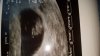 IMG-20170322-WA0000.jpg