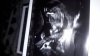 IMG-20170318-WA0042.jpg