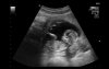 baby1.jpg