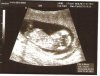 Baby in de buik 004.jpg