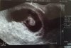 1e echo 7,5 week zonder naam.jpg