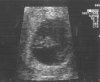 echo 8 weken 10-10-12.jpg