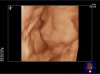 BABY-_PORCK-_2_20121005_RT-_3D-_2-_-R_0005-2.jpg