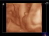 BABY-_PORCK-_2_20121005_RT-_3D-_2-_-R_0007-1.jpg