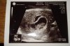 echo 11-10-2012.jpg