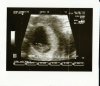 Baby 7 + 4.jpg