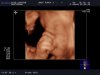 BABY-_PORCK-_2_20121015_RT-_3D-_2-_-R_0024.jpg