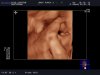 BABY-_PORCK-_2_20121015_RT-_3D-_2-_-R_0027.jpg