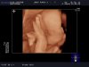BABY-_PORCK-_2_20121015_RT-_3D-_2-_-R_0031.jpg
