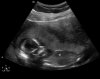 12-10-15-150341_BABY VAN DE LANG_20121015_150341_0006.jpg