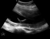 12-10-15-150341_BABY VAN DE LANG_20121015_150341_0007.jpg