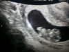 1e echo 25-09-2012.jpg