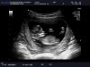1342_20121006_NT-_ABDOMEN_0012.jpg