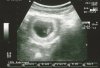 echo 18-10-12.jpg
