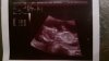 baby 15 weken - 1.jpg