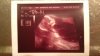 baby 15 weken - 2.jpg