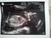 20 weken echo baby Maart.jpg